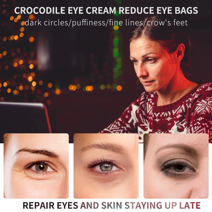 20g Peptide Collagen Eye Essence Cream Anti Wrinkle Anti Dark Circles Eye Bags Eyes Puffy Repair Korean Cosmetics Eye Care - Vogue Vista UK