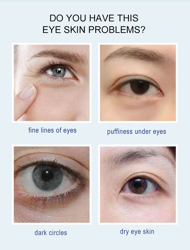 ARTISCARE Hyaluron Acid Eye Masks 60pcs for Removal Puffiness Dark Circles Moisturizing Fade Wrinkles Collagen Gel Eye Patches - Vogue Vista UK