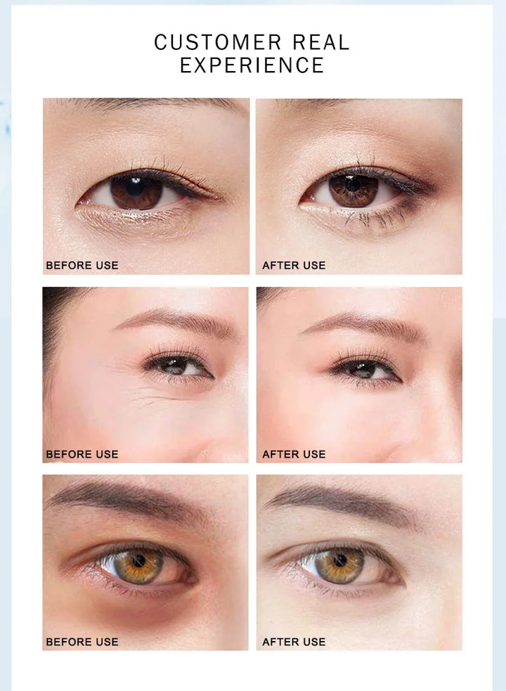 ARTISCARE Hyaluron Acid Eye Masks 60pcs for Removal Puffiness Dark Circles Moisturizing Fade Wrinkles Collagen Gel Eye Patches - Vogue Vista UK