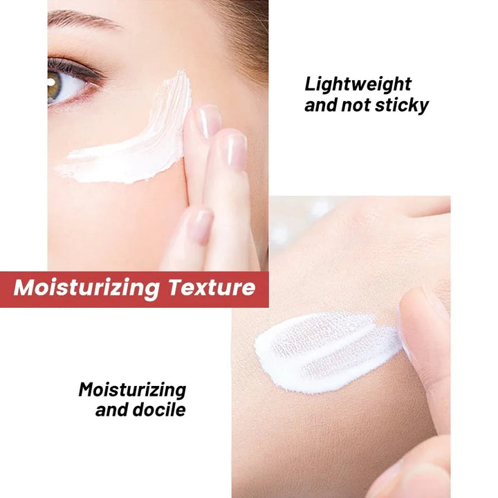 20g Whitening Freckle Cream Remove Dark Spot Cream Anti Freckle and Aging Cream Fade Pigmentation Melasma Brighten Serum Skin - Vogue Vista UK