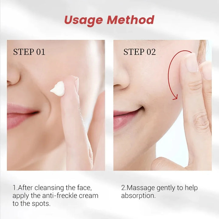 20g Whitening Freckle Cream Remove Dark Spot Cream Anti Freckle and Aging Cream Fade Pigmentation Melasma Brighten Serum Skin - Vogue Vista UK