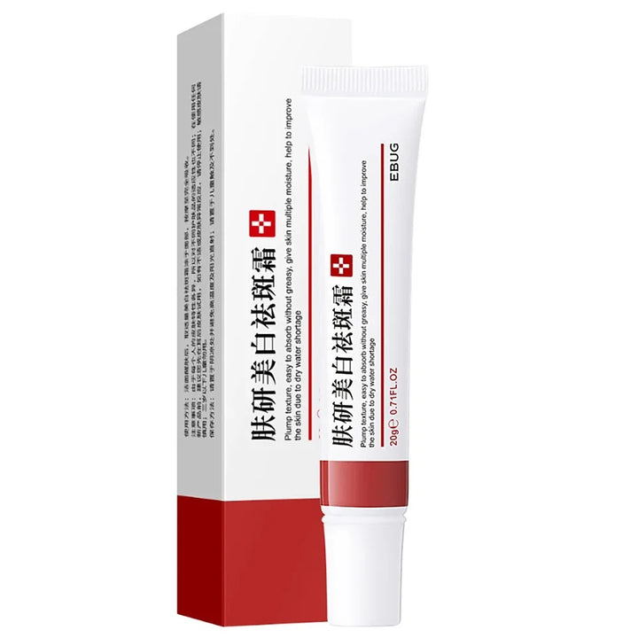 20g Whitening Freckle Cream Remove Dark Spot Cream Anti Freckle and Aging Cream Fade Pigmentation Melasma Brighten Serum Skin - Vogue Vista UK